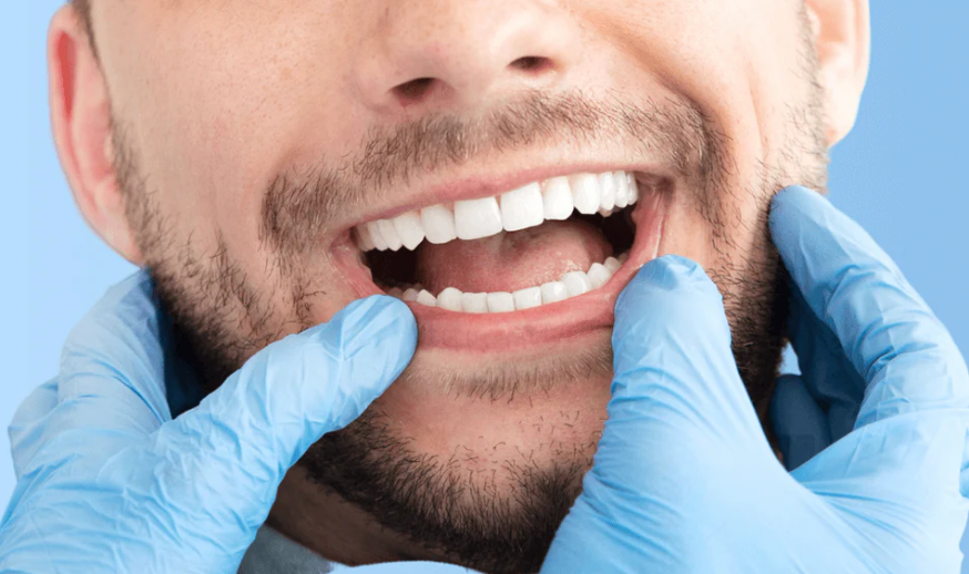 Le fluor dans le dentifrice : un allié pour des dents saines